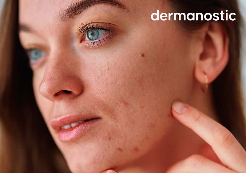 Frau mit Ausschlag im Gesicht