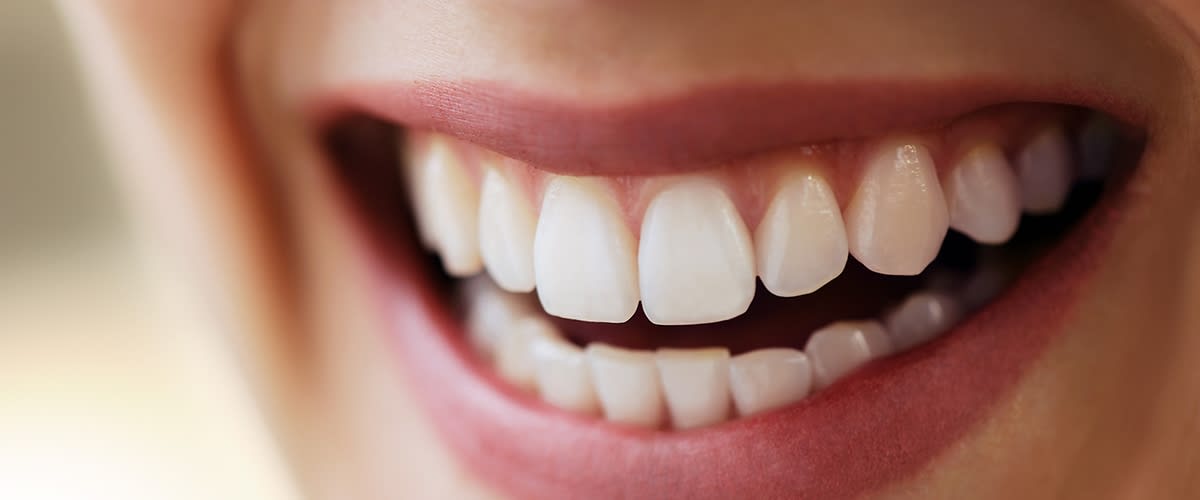 Ein lächelnder Mund mit weißen, gepflegten Zähnen