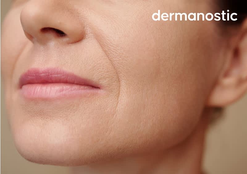 Der Schriftzug „dermanostic“ ist in weißer Farbe oben rechts im Bild zu sehen. Auf dem Bild ist die untere Gesichtshälfte einer Person abgebildet. Sie lächelt leicht und hat leichte Lachfalten