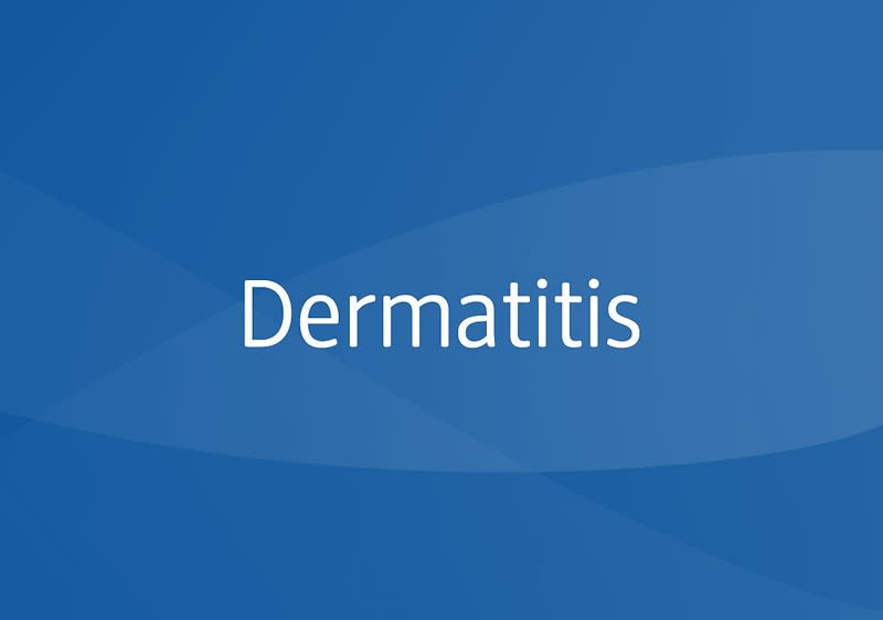 Blauer Hintergrund mit dem weißen Wort „Dermatitis“ in der Bildmitte