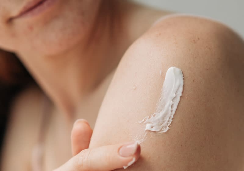 Frau trägt mit Finger eine weiße Creme auf die freiliegende Schulter auf