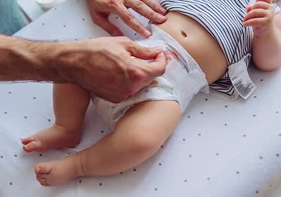 Baby auf dem Wickeltisch – hoffentlich keine Windeldermatitis