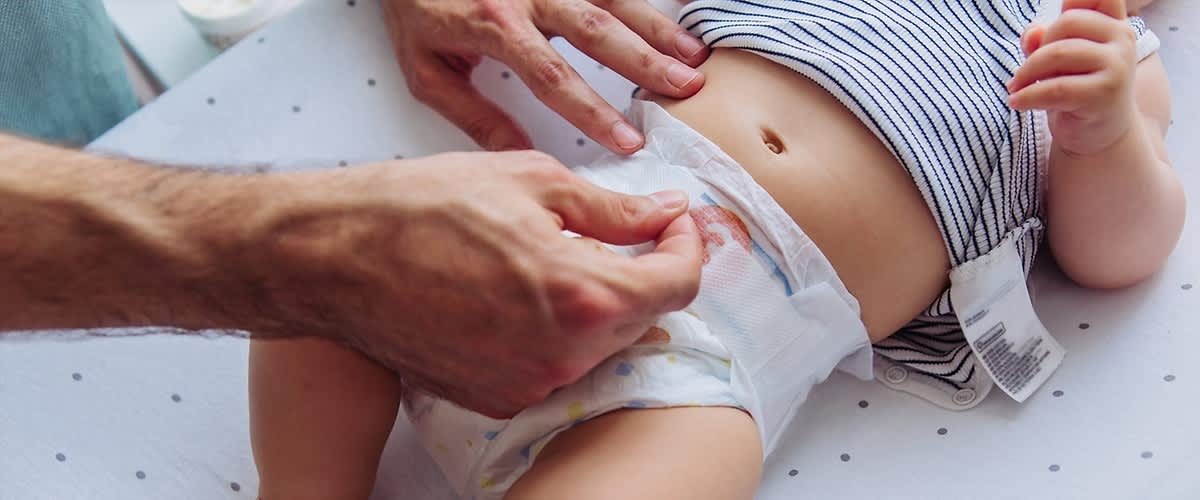 Baby auf dem Wickeltisch – hoffentlich keine Windeldermatitis