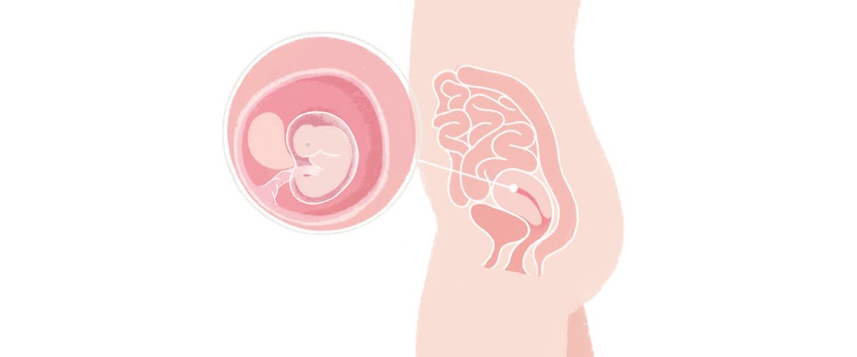 Baby in der 6. SSW