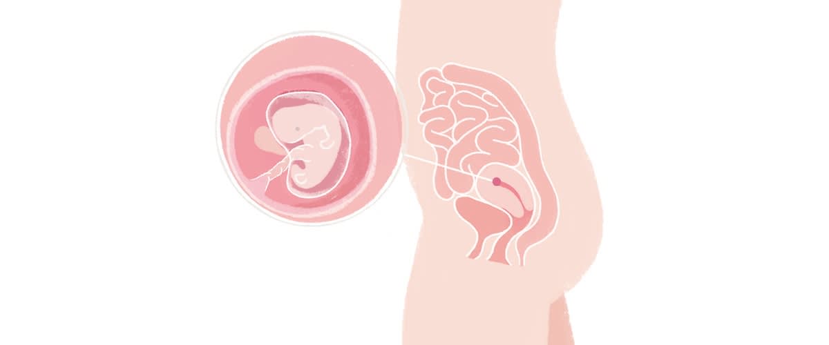 Baby in der 7. SSW