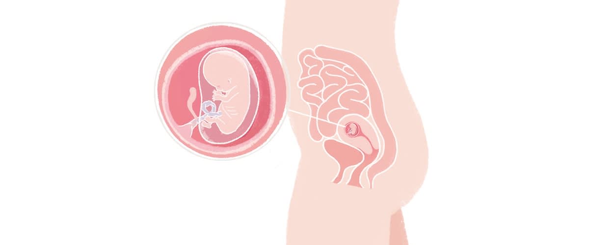 Baby in der 10. SSW