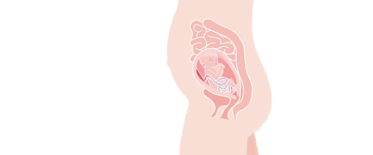 Baby in der 23. SSW
