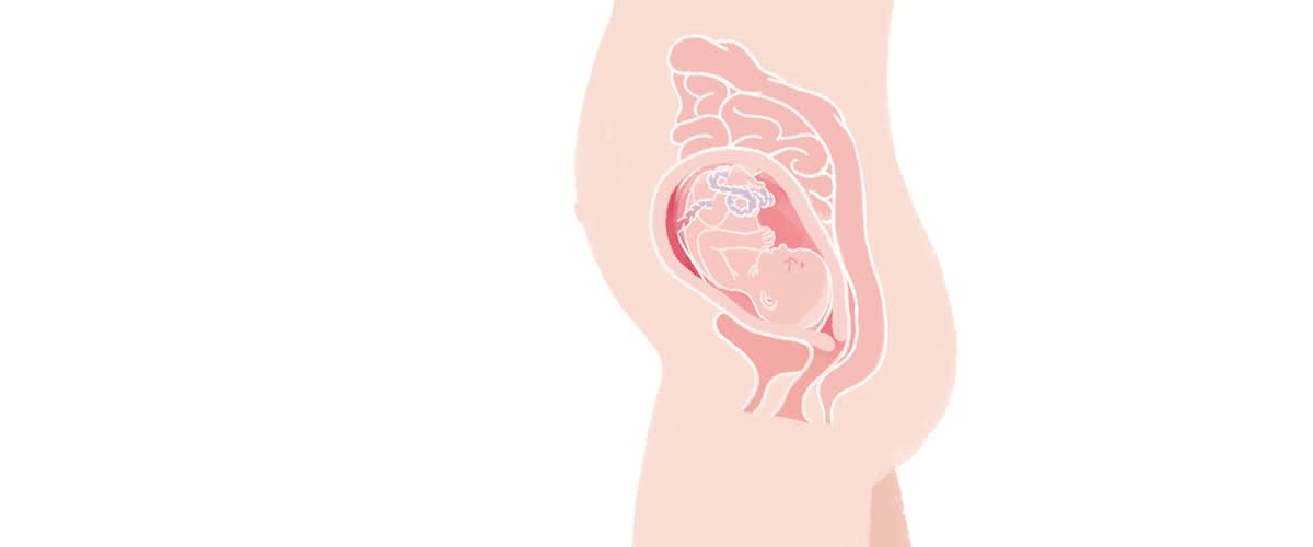 Baby in der 25. SSW