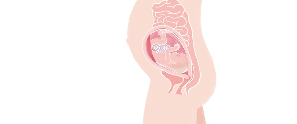 Baby in der 27. SSW