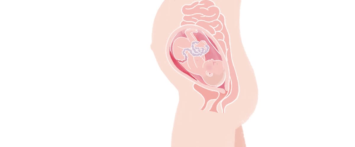 Baby in der 28. SSW