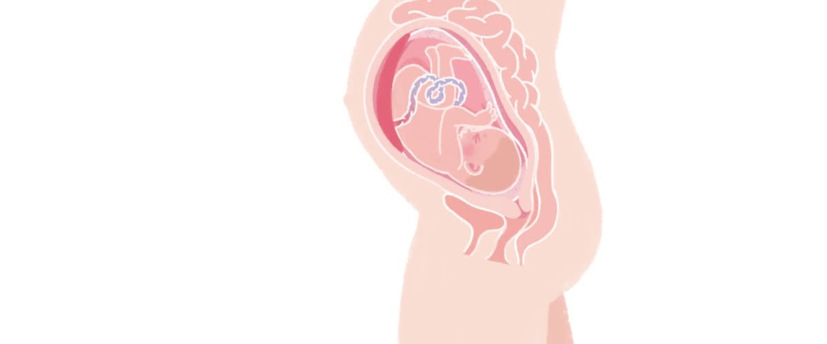 Baby in der 30. SSW