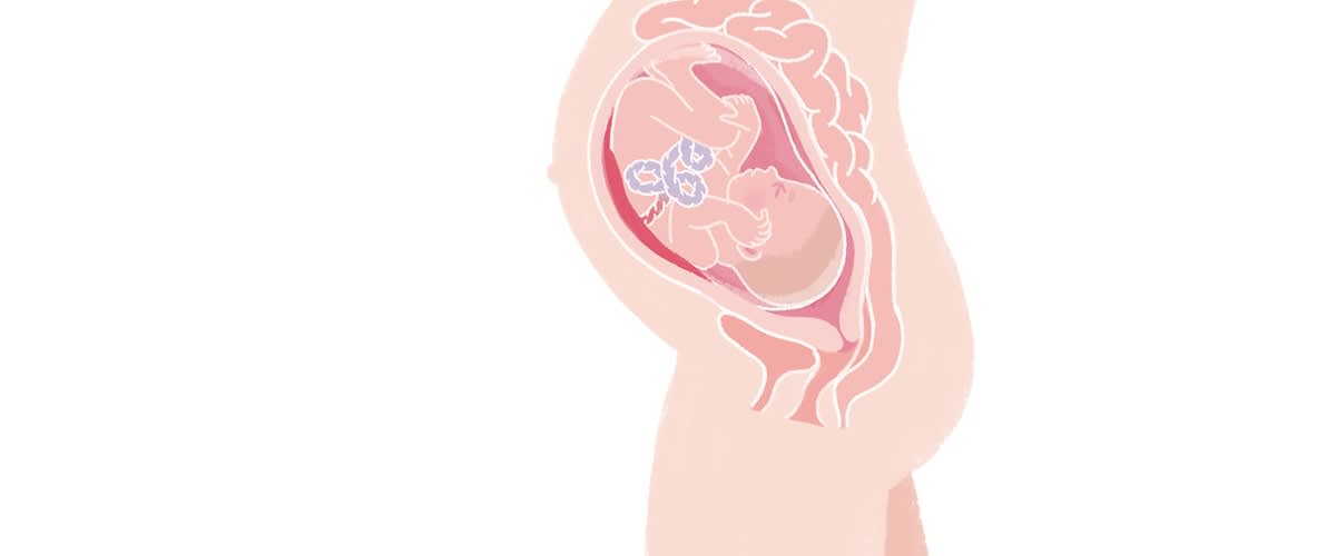 Baby in der 32. SSW