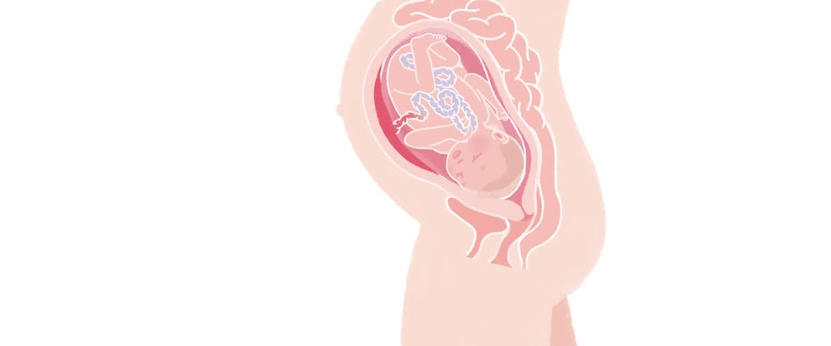 Baby in der 33. SSW