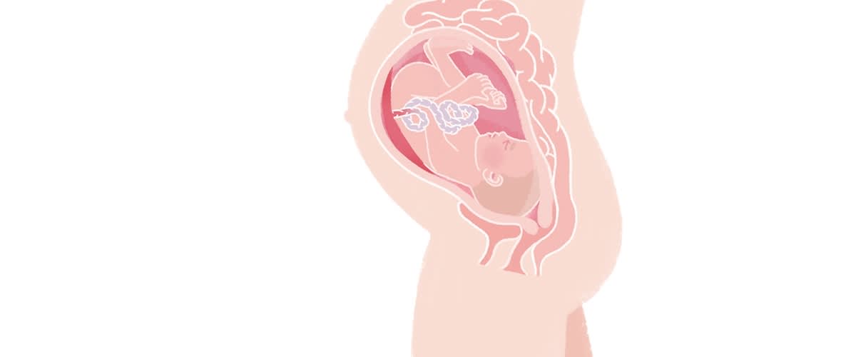 Baby in der 34. SSW