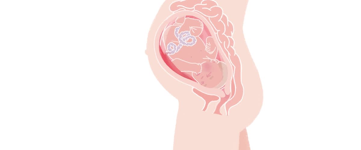 Baby in der 36. SSW