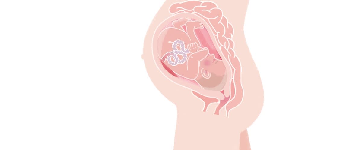 Baby in der 37. SSW