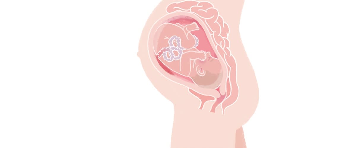 Baby in der 38. SSW