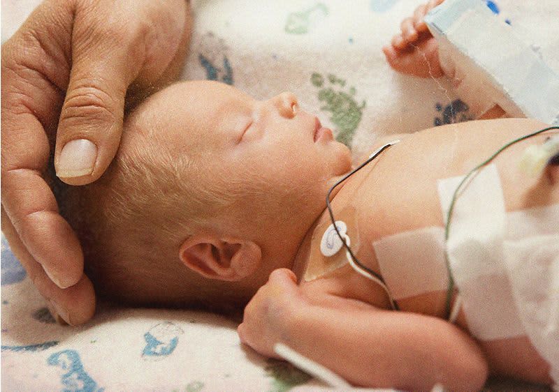 Hand hält schlafenden Frühchen Kopf