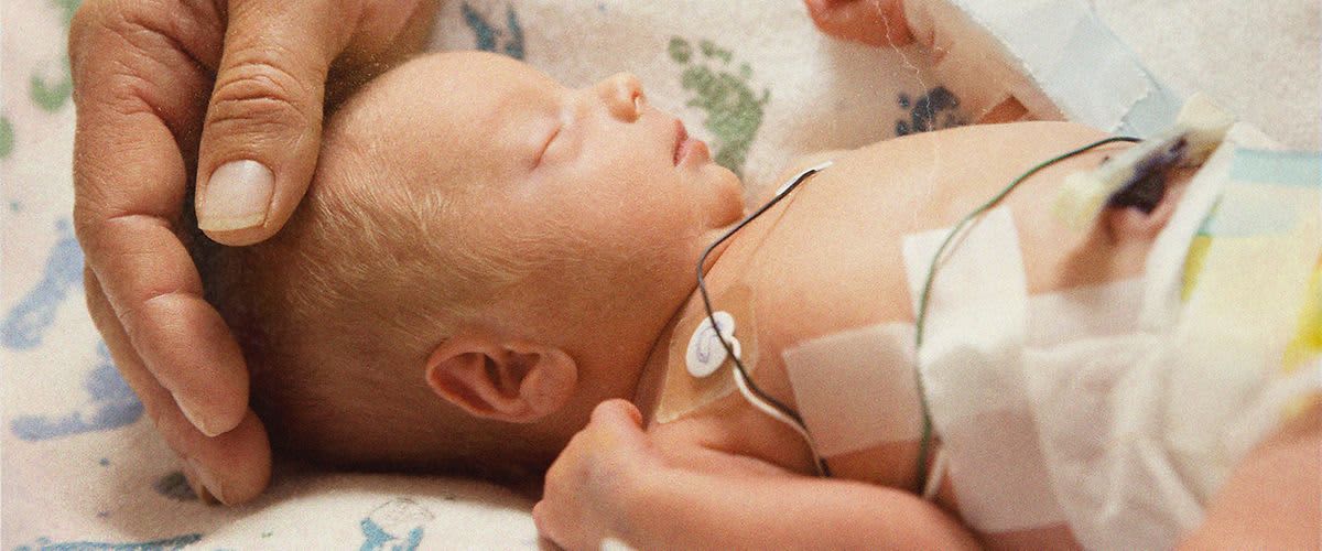 Hand hält schlafenden Frühchen Kopf