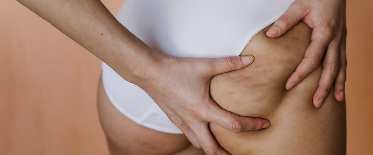 Anticelulitna masaža