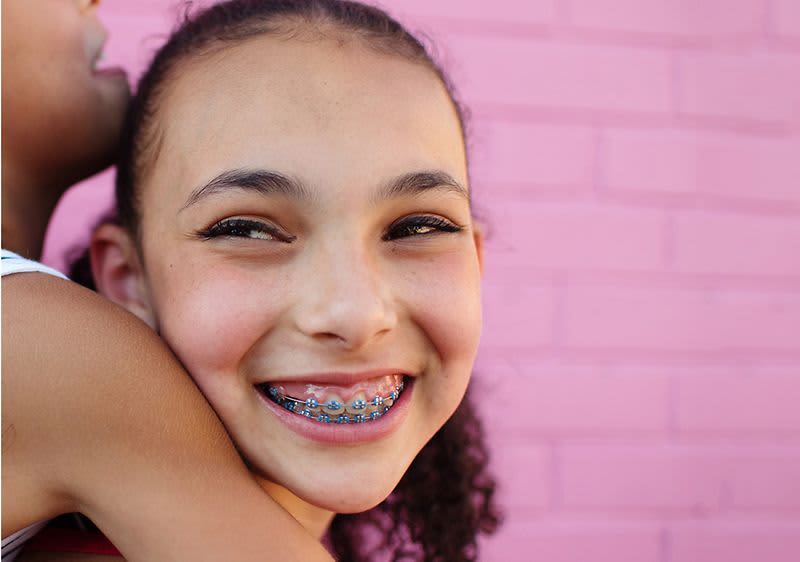 Čišćenje aparatića za zube