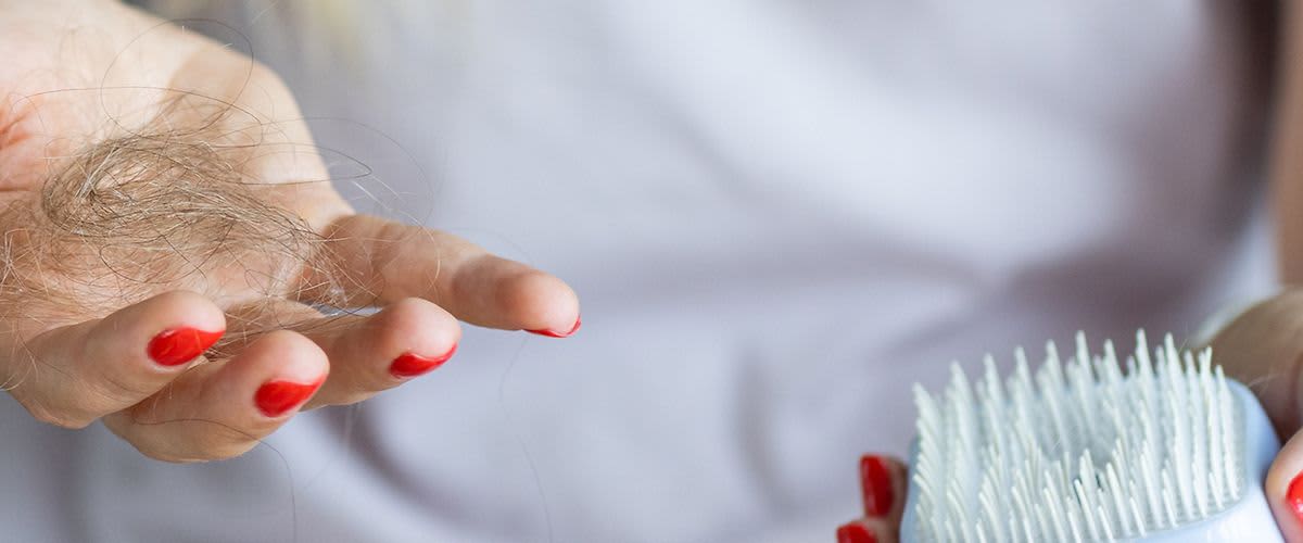 Gubitak kose – što učiniti?| 