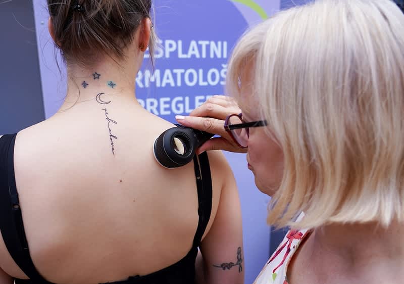 dermatološki pregled kože