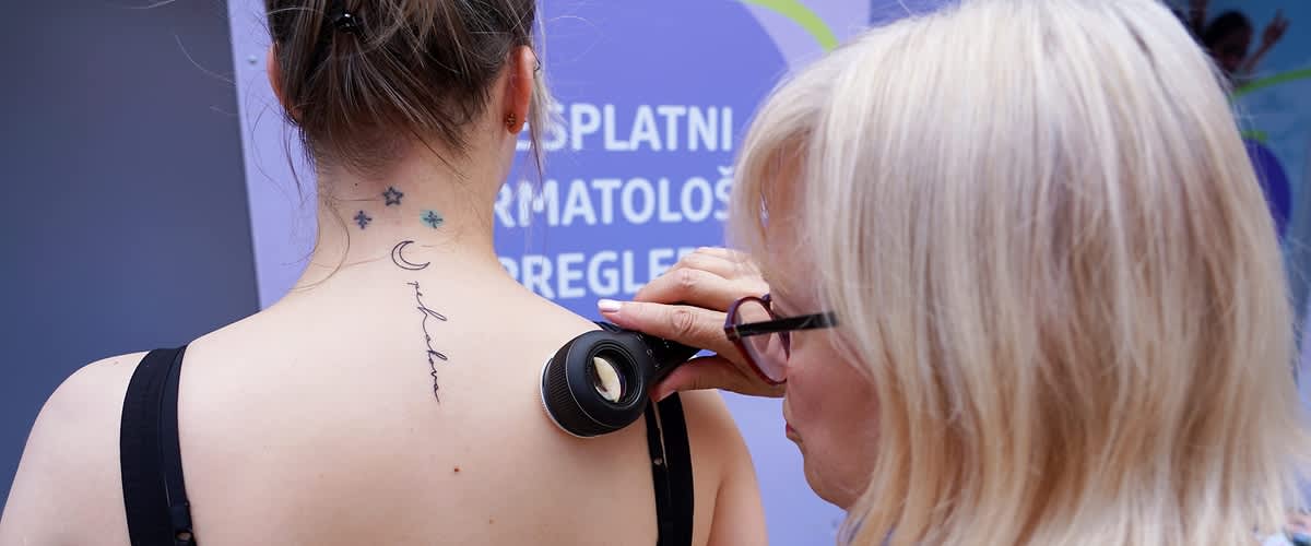 dermatološki pregled kože