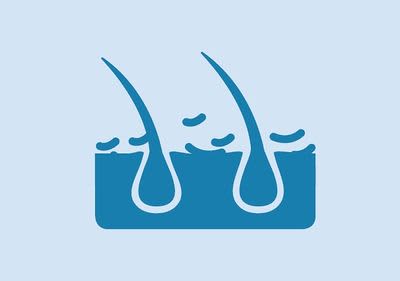 Osjetljivo vlasište perut