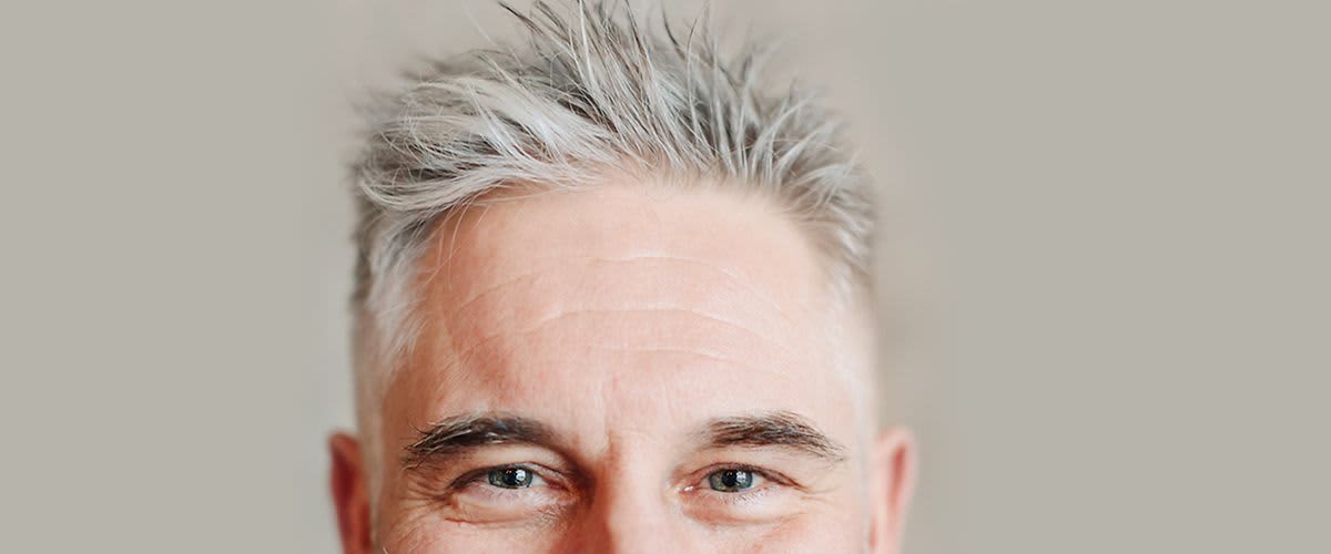 Sijeda kosa: je li to uzrok za paniku kod muškaraca? 