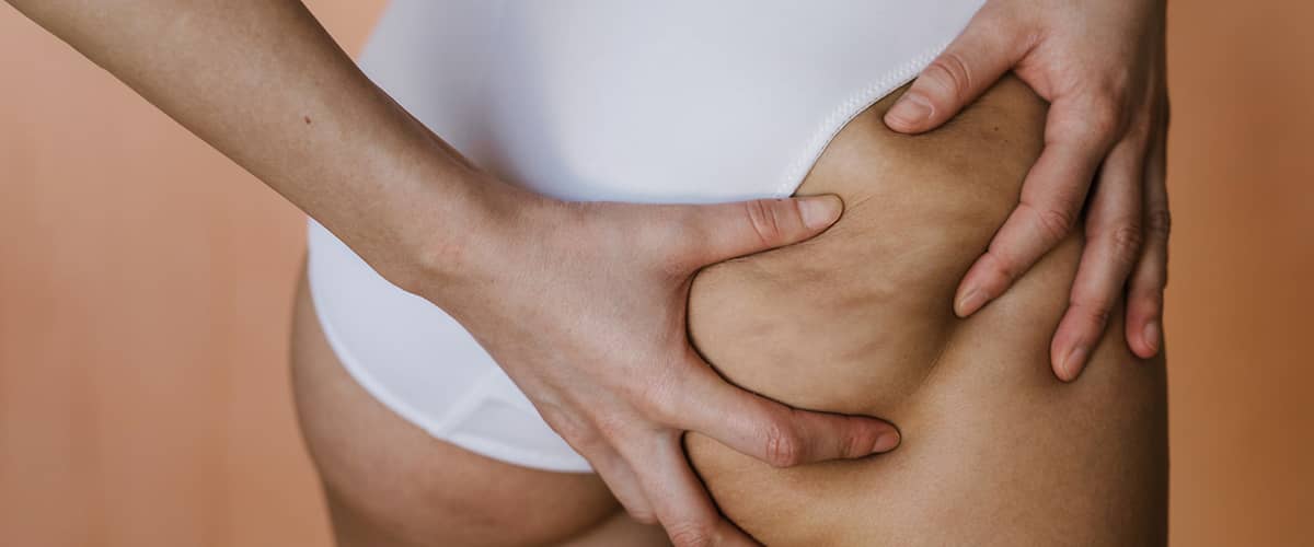 Narancsbőr elleni masszázs