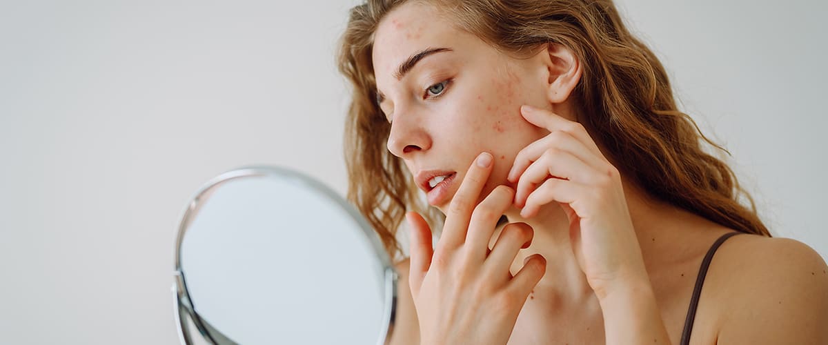 Fiatal nő nézegeti a bőrét a tükörben