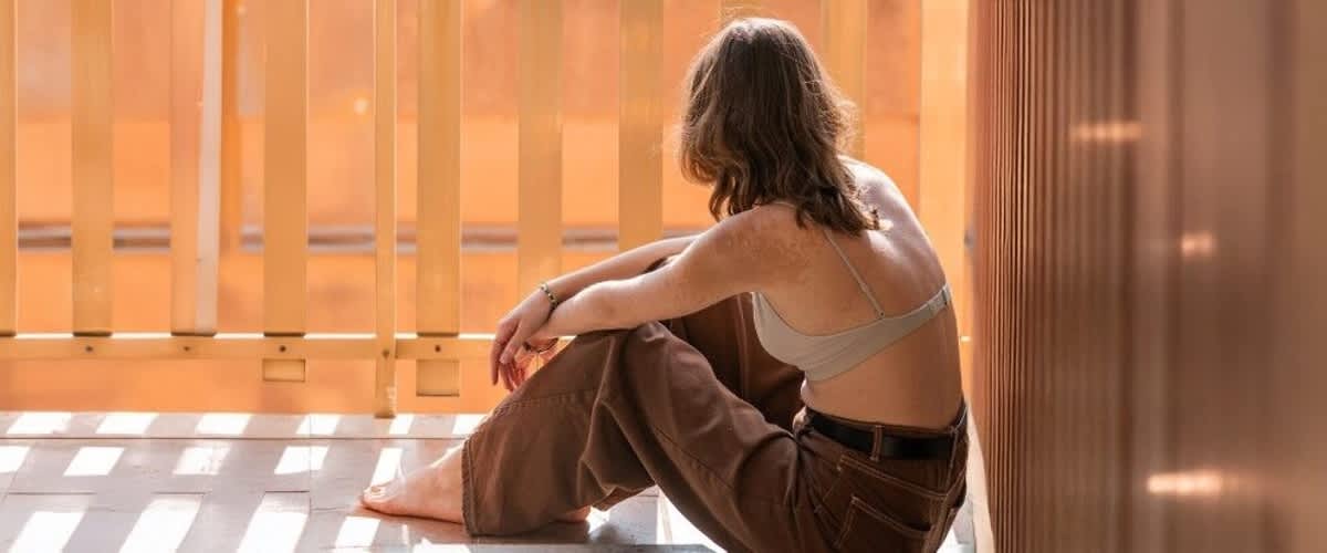 Donna seduta in balcone con pantaloni larghi e top e macchie pigmentate sul corpo