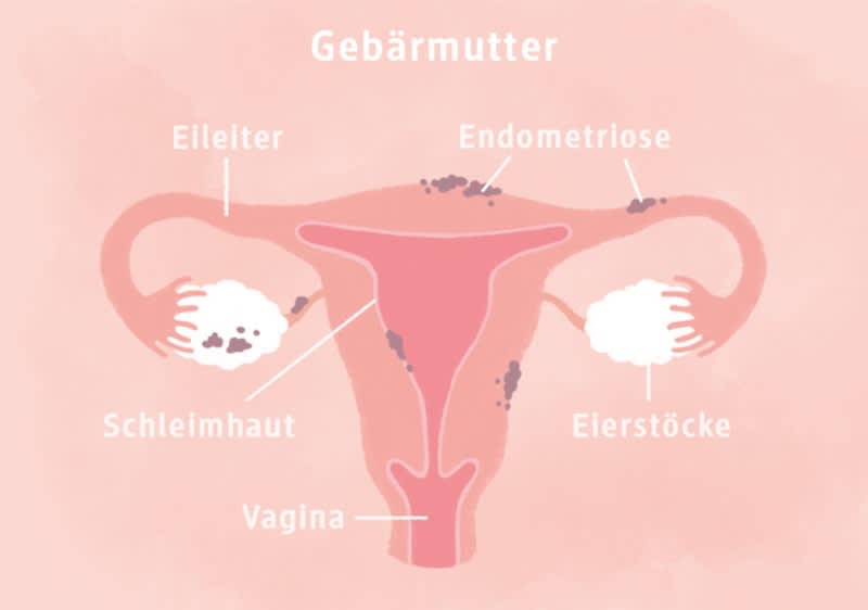 Gebärmutter Schaubild