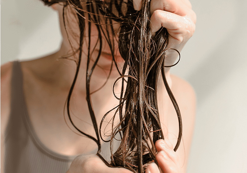 Izpadanje las pri ženskah slika