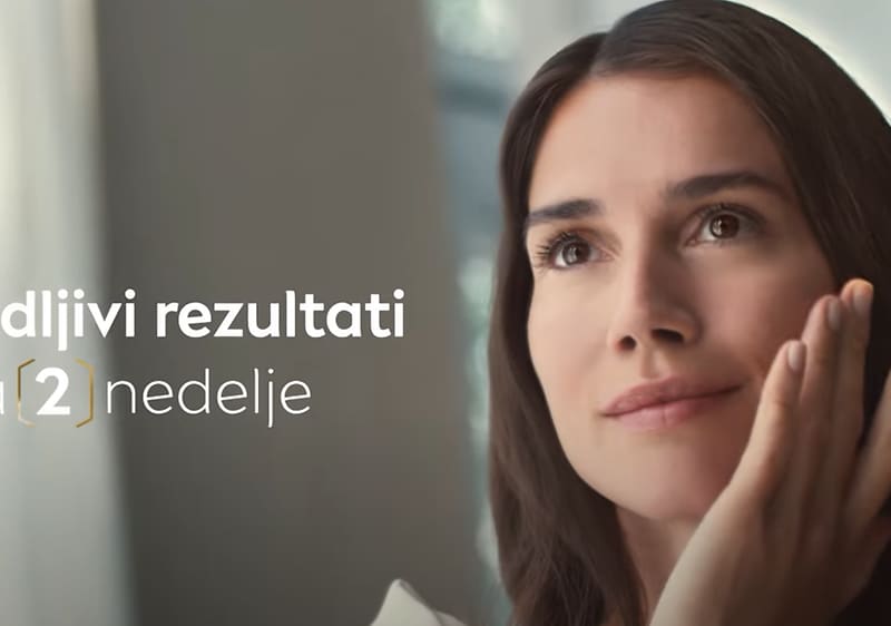 Bez pigmentnih fleka uz NIVEA Cellular Luminous630!