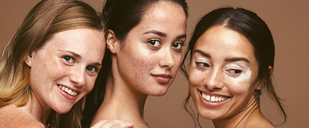 Tri žene različitih tipova kože