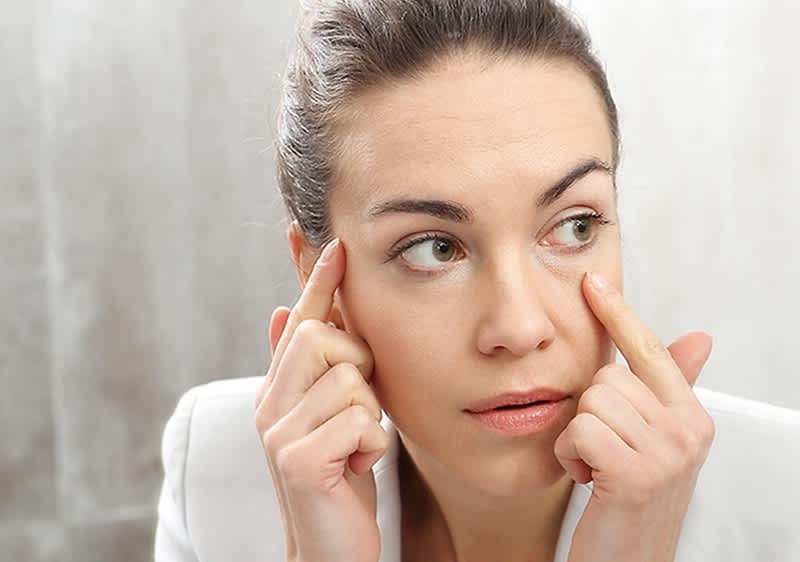 Mlada žena sa tamnim podočnjaka