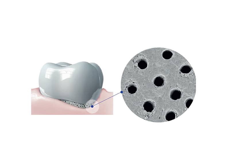 Како да ја спречите и лекувате чувствителноста на забите?